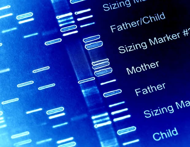 Mayo Clinic Study Reveals How Genetic Testing Is Rewriting Pulmonary Fibrosis Care Protocols