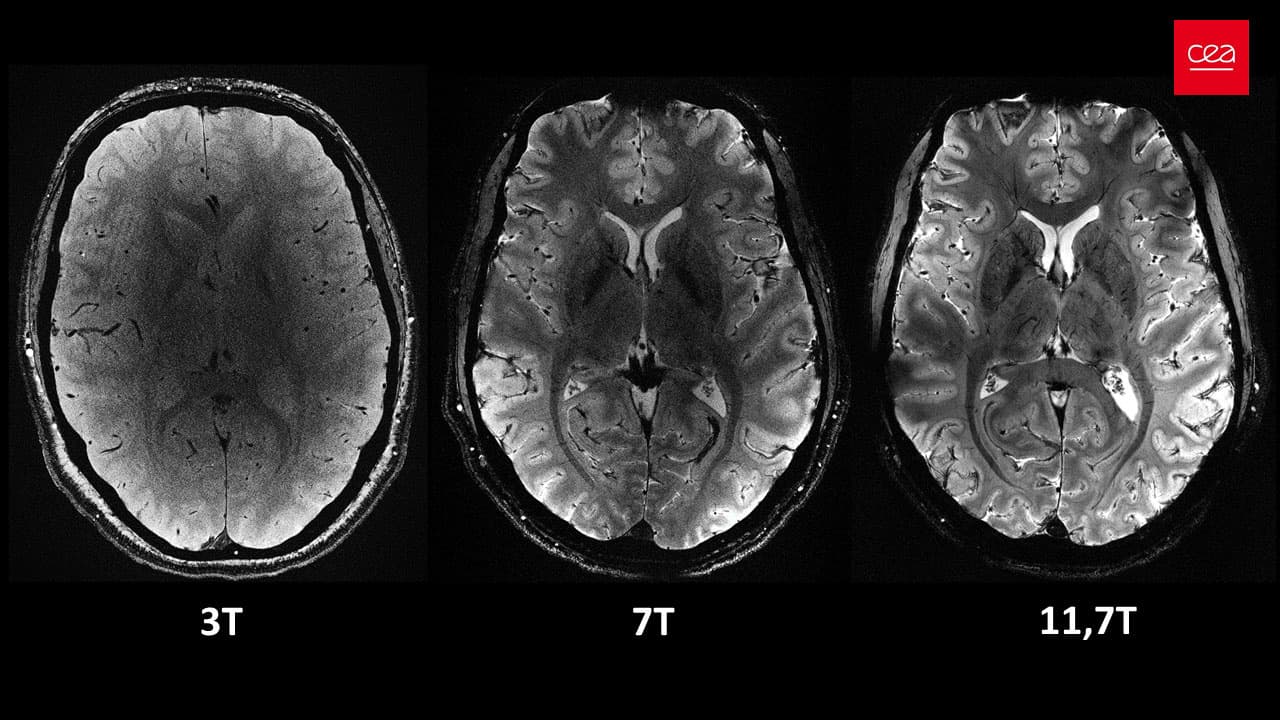 Hospital-Trained AI Crushes GPT-5 in Brain Imaging, Proving Clinical Data Beats Internet Scale