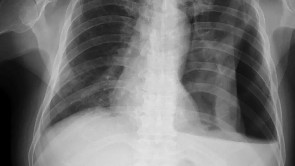Medical Imaging Giant Aidoc Pursues Historic FDA Clearance for AI That Writes Radiology Reports