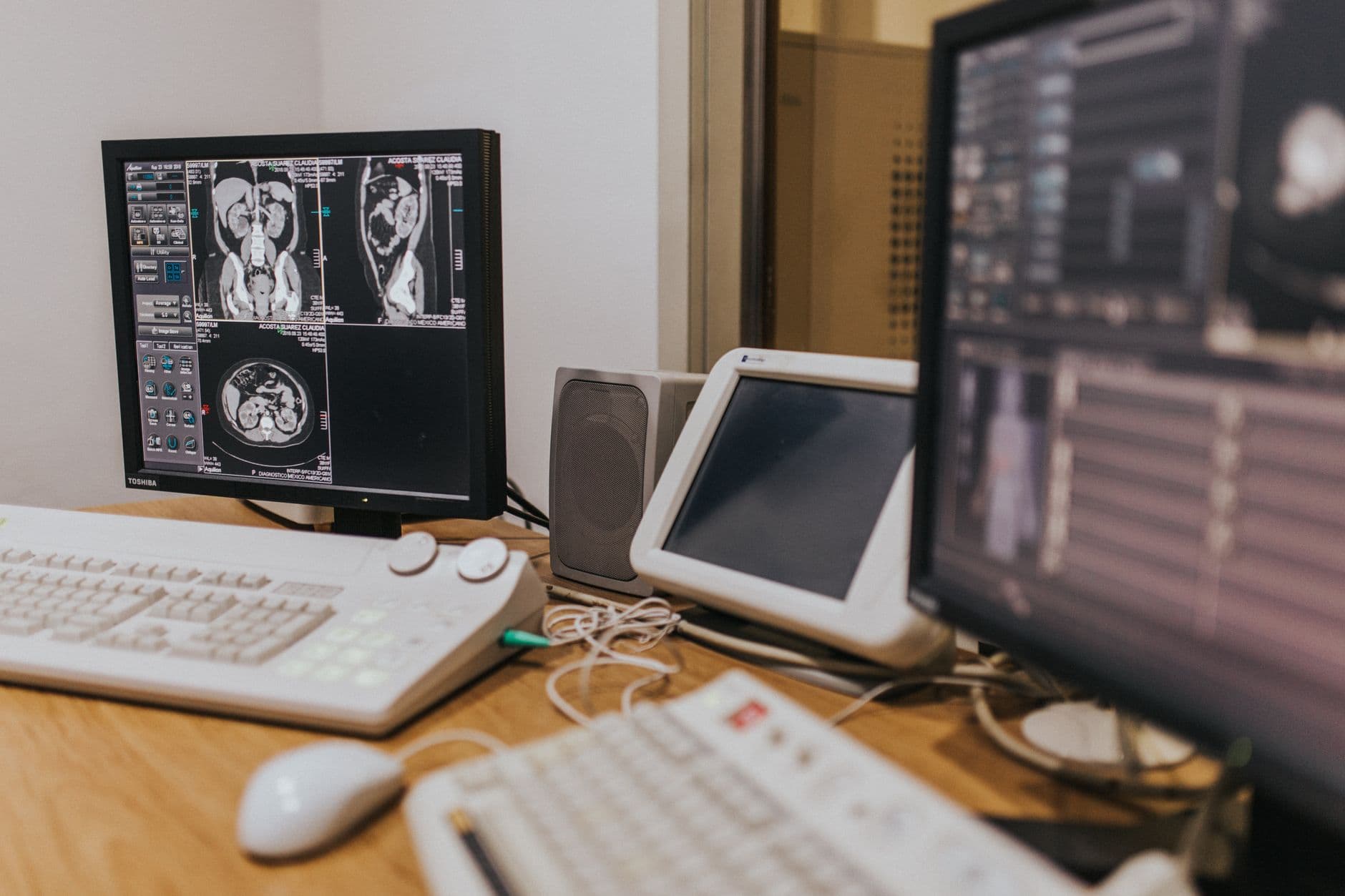 AI Spots Hidden Pancreatic Cancer Signals 16 Months Before Doctors See It