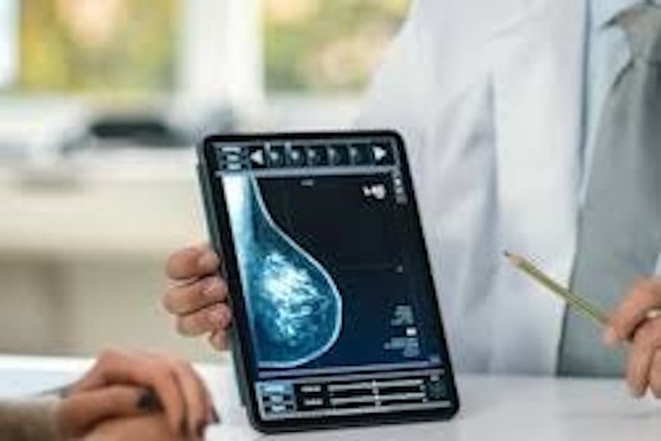 AI Mammography Tool Now Quantifies Heart Risk: CureMetrix Wins FDA Nod for Enhanced Cardiovascular Screening