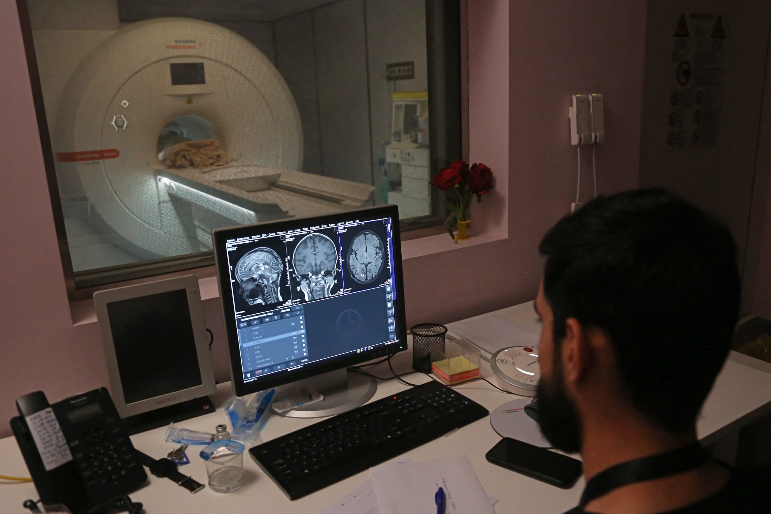 AI Reads Anger in Brain Scans to Predict Depression Years Before Symptoms Emerge