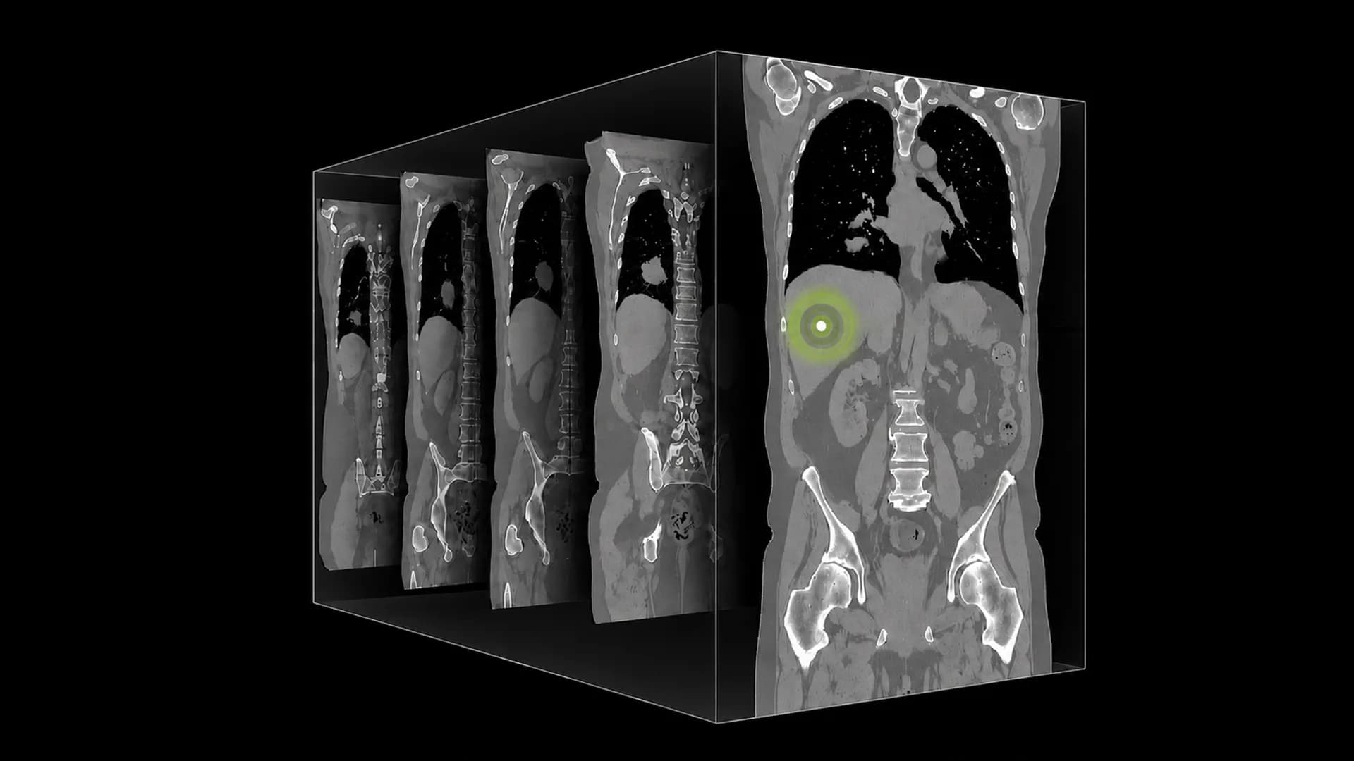 NVIDIA's New AI Model Thinks Like a Radiologist to Read CT Scans in 3D