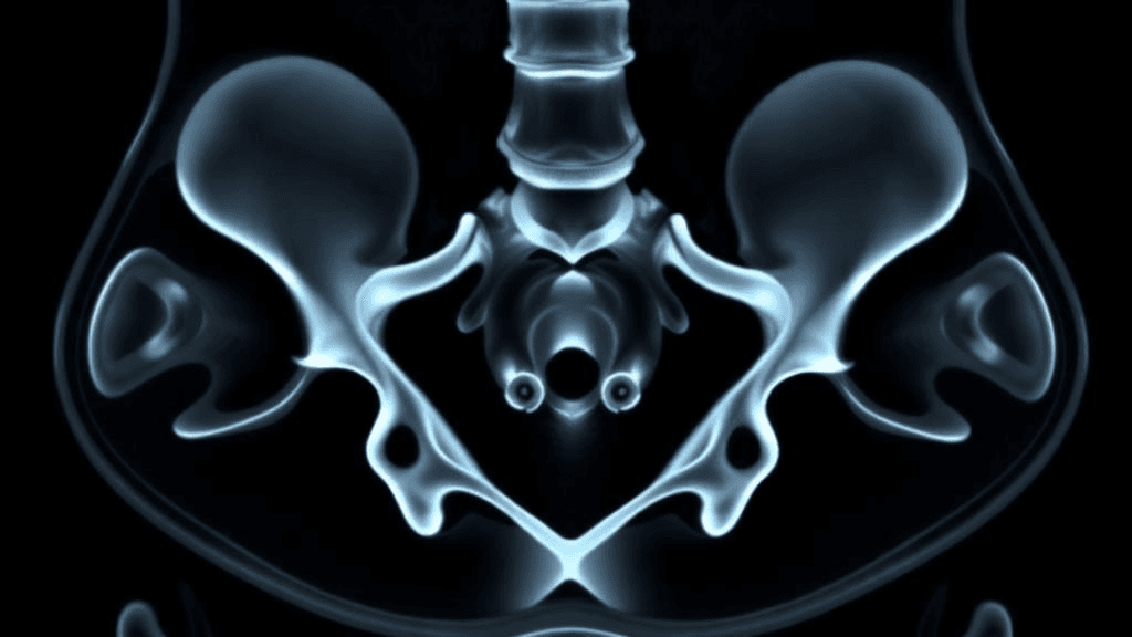 Routine CT Scans Could Reveal Hidden Osteoporosis Risk Without Extra Radiation, Chinese Study Finds
