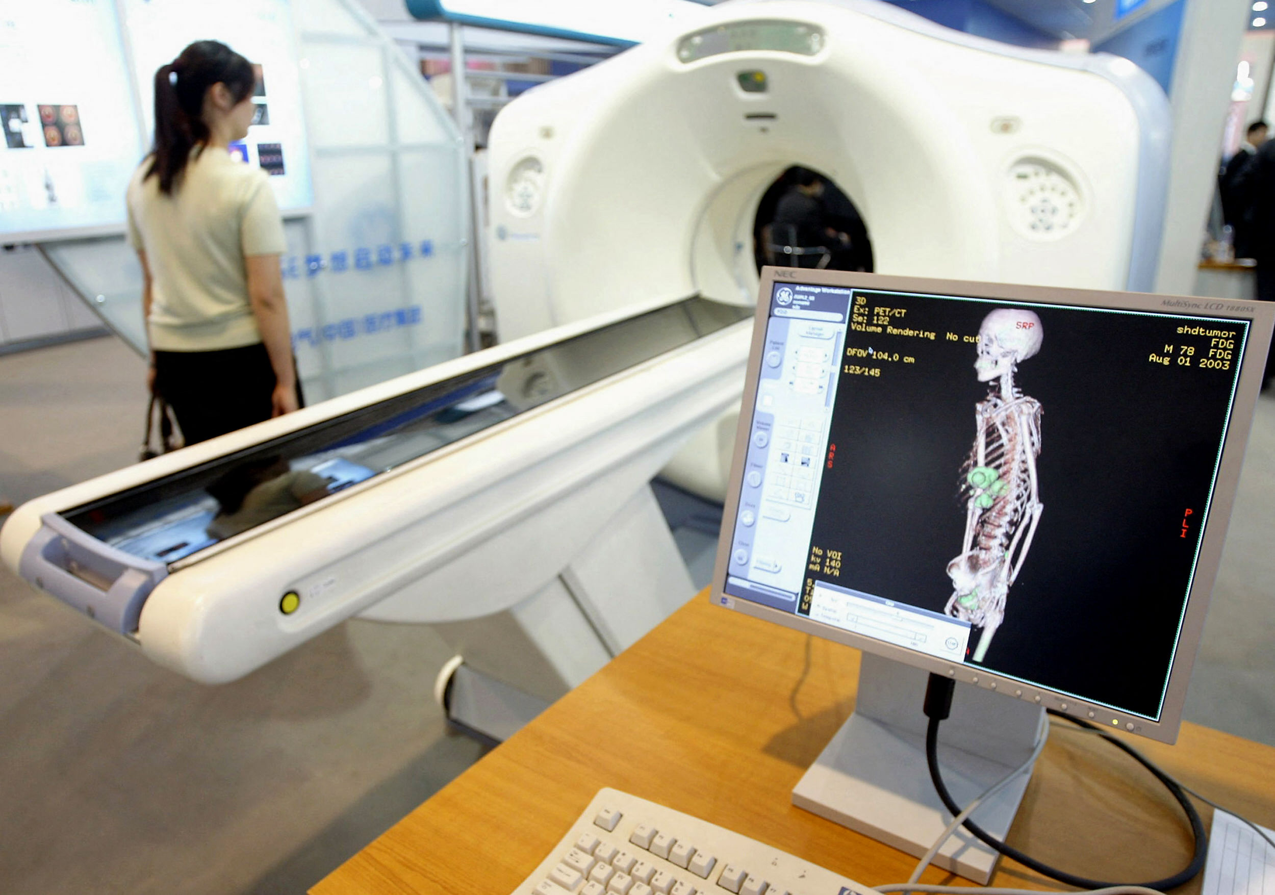 One AI System Just Beat Nearly Every Radiologist It Faced—And It's Free to Download